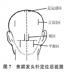 ǳ����ͷ��Ѩ�����ʱ�׼���������Ŀ�ѧ��