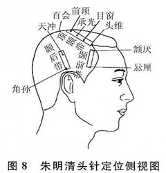 ǳ����ͷ��Ѩ�����ʱ�׼���������Ŀ�ѧ��