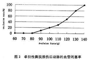 牵拉性撕脱伤对动脉闭塞率的影响