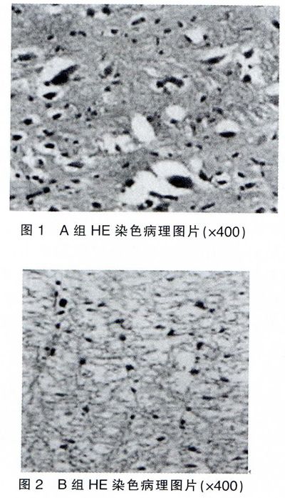 生酮饮食对在体兔脊髓缺血再灌注损伤的影响